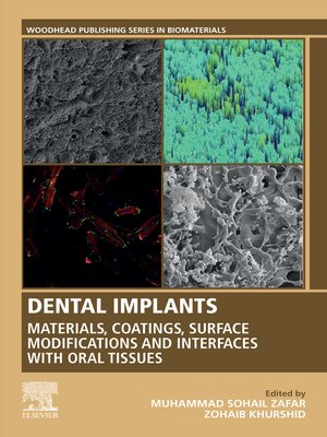 cover image of Dental Implants